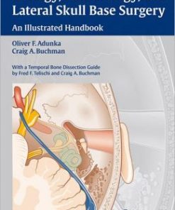 Otology, Neurotology, and Lateral Skull Base Surgery: An Illustrated Handbook