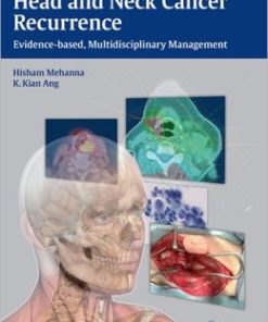 Head and Neck Cancer Recurrence: Evidence-Based, Multidisciplinary Management (PDF)