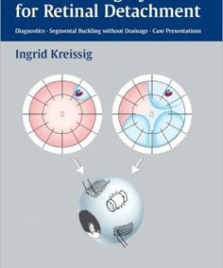 A Practical Guide to Minimal Surgery for Retinal Detachment, Volume 1