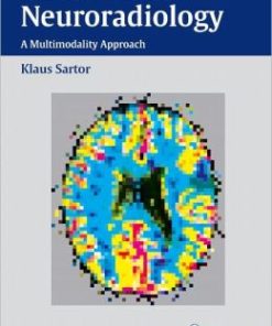 Diagnostic and Interventional Neuroradiology