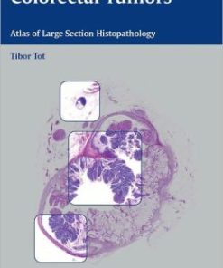 Colorectal Tumors: Atlas of Large Section Histopathology