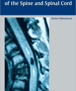 MR Imaging of the Spine and Spinal Cord