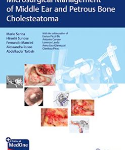 Microsurgical Management of Middle Ear and Petrous Bone Cholesteatoma (PDF)