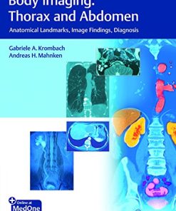 Body Imaging: Thorax and Abdomen: Anatomical Landmarks, Image Findings, Diagnosis (PDF)