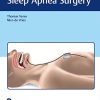 Current Concepts of Sleep Apnea Surgery (PDF)