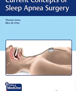 Current Concepts of Sleep Apnea Surgery (PDF)