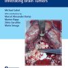 Video Atlas of Neurophysiological Monitoring in Surgery of Infiltrating Brain Tumors (PDF Book+Videos)