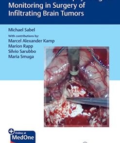 Video Atlas of Neurophysiological Monitoring in Surgery of Infiltrating Brain Tumors (PDF Book+Videos)