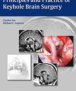 Principles and Practice of Keyhole Brain Surgery (Videos Only)