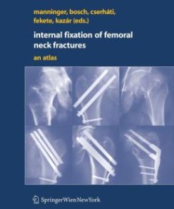 Internal fixation of femoral neck fractures: An Atlas (PDF)