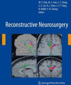 Reconstructive Neurosurgery (PDF)