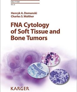 FNA Cytology of Soft Tissue and Bone Tumors (Monographs in Clinical Cytology, Vol. 22) (PDF)