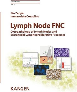 Lymph Node FNC: Cytopathology of Lymph Nodes and Extranodal Lymphoproliferative Processes (Monographs in Clinical Cytology, Vol. 23) (PDF)