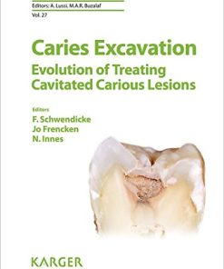 Caries Excavation: Evolution of Treating Cavitated Carious Lesions (Monographs in Oral Science, Vol. 27) (PDF)
