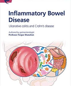 Fast Facts: Inflammatory Bowel Disease for Patients and their Supporters: Ulcerative colitis and Crohn’s disease Information + Taking Control = Best Outcome (PDF)