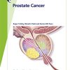 Fast Facts: Prostate Cancer: If, when and how to intervene (PDF)