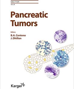 Pancreatic Tumors (Monographs in Clinical Cytology, Vol. 26) (PDF)