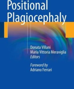 Positional Plagiocephaly (PDF)