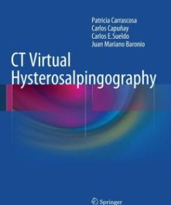 CT Virtual Hysterosalpingography (EPUB)