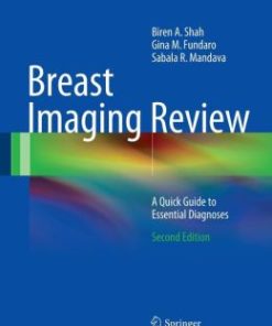 Breast Imaging Review: A Quick Guide to Essential Diagnoses (EPUB)