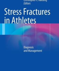 Stress Fractures in Athletes: Diagnosis and Management (PDF)