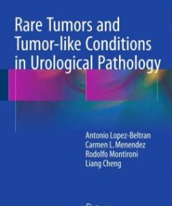 Rare Tumors and Tumor-like Conditions in Urological Pathology