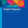 Ectopic Pregnancy: A Clinical Casebook (PDF)