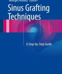 Sinus Grafting Techniques: A Step-by-Step Guide (EPUB)