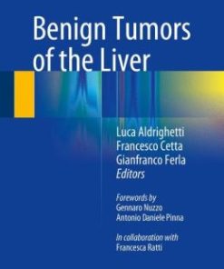 Benign Tumors of the Liver (PDF)