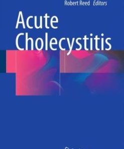 Acute Cholecystitis (PDF)