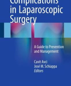 Complications in Laparoscopic Surgery: A Guide to Prevention and Management (PDF)