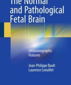 The Normal and Pathological Fetal Brain: Ultrasonographic Features (PDF)