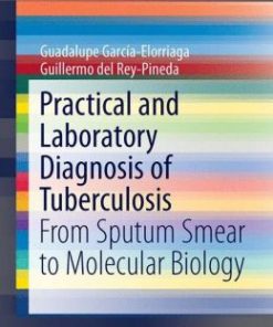 Practical and Laboratory Diagnosis of Tuberculosis: From Sputum Smear to Molecular Biology (EPUB)