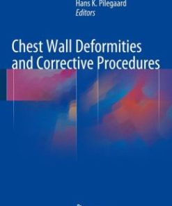 Chest Wall Deformities and Corrective Procedures (PDF)