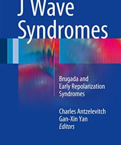 J Wave Syndromes: Brugada and Early Repolarization Syndromes (PDF)