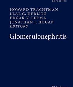 Glomerulonephritis (PDF)