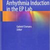 Arrhythmia Induction in the EP Lab