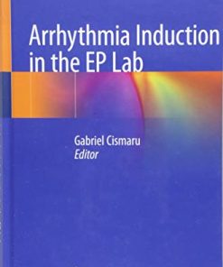 Arrhythmia Induction in the EP Lab