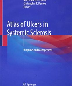 Atlas of Ulcers in Systemic Sclerosis: Diagnosis and Management (EPUB)