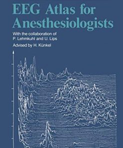 EEG Atlas for Anesthesiologists (PDF)