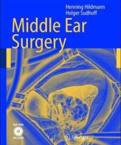 Middle Ear Surgery (PDF)