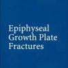 Epiphyseal Growth Plate Fractures (PDF)