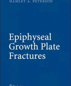 Epiphyseal Growth Plate Fractures (PDF)