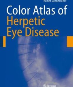 Color Atlas of Herpetic Eye Disease: A Practical Guide to Clinical Management (PDF)