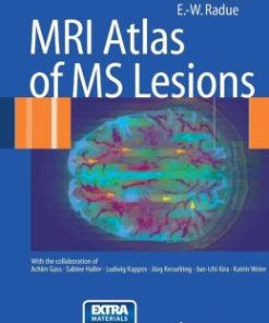 MRI Atlas of MS Lesions (PDF)