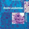 Hematologic Malignancies: Acute Leukemias (PDF)