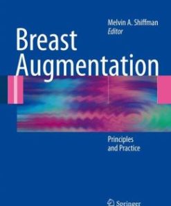 Breast Augmentation: Principles and Practice (PDF)