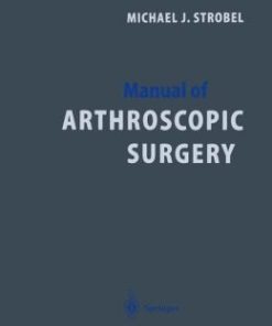 Manual of Arthroscopic Surgery