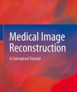 Medical Image Reconstruction: A Conceptual Tutorial (PDF)