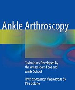 Ankle Arthroscopy: Techniques Developed by the Amsterdam Foot and Ankle School (PDF)